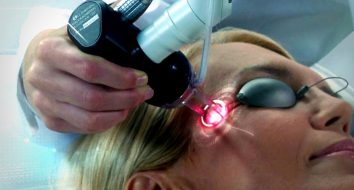 Фракционный СО2 лазер: мощный инструмент в мире косметологии и дерматологии